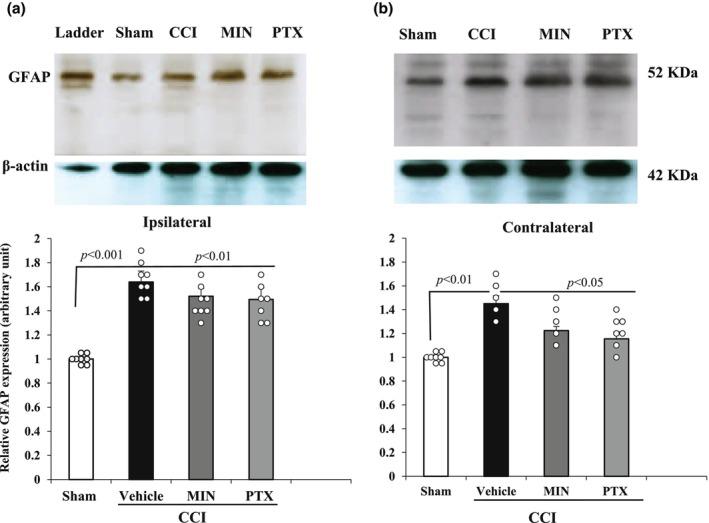https://cdn.ncbi.nlm.nih.gov/pmc/blobs/8dc4/12018164/32424d9f1128/PHY2-13-e70318-g001.jpg