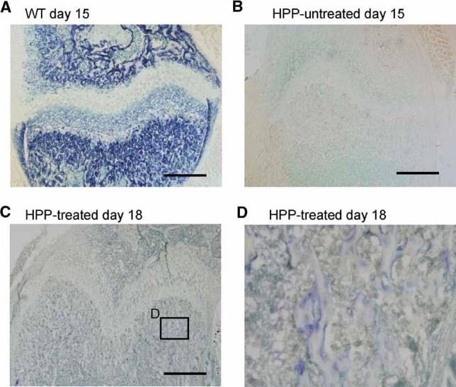 https://cdn.ncbi.nlm.nih.gov/pmc/blobs/8dc6/3179312/e82d55a5dd30/jbmr0026-0135-f3.jpg