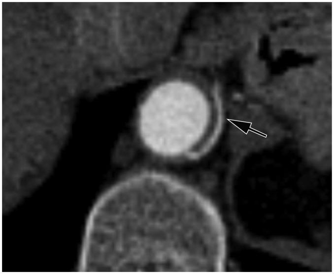 https://cdn.ncbi.nlm.nih.gov/pmc/blobs/8dcd/5313521/d6465108cd8c/kjr-18-336-g006.jpg