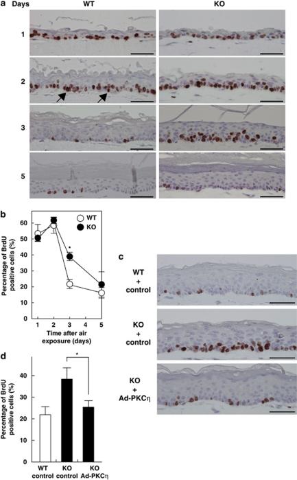 https://cdn.ncbi.nlm.nih.gov/pmc/blobs/8dd1/3122119/0cb30c2e44b3/cddis201140f2.jpg