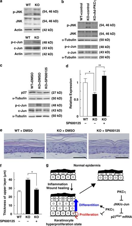 https://cdn.ncbi.nlm.nih.gov/pmc/blobs/8dd1/3122119/84728ac3fabd/cddis201140f6.jpg