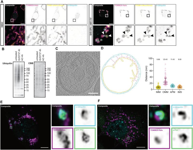 https://cdn.ncbi.nlm.nih.gov/pmc/blobs/8dd5/10923902/f97b09ed0647/41418_2024_1260_Fig5_HTML.jpg