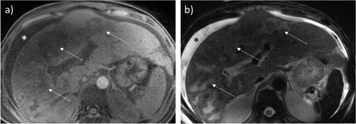 https://cdn.ncbi.nlm.nih.gov/pmc/blobs/8dd9/10899155/4c9e31272950/13244_2024_1622_Fig3_HTML.jpg