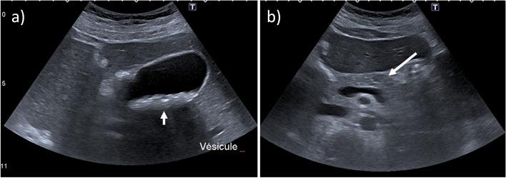 https://cdn.ncbi.nlm.nih.gov/pmc/blobs/8dd9/10899155/cdf663dfc4a3/13244_2024_1622_Fig1_HTML.jpg