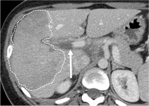 https://cdn.ncbi.nlm.nih.gov/pmc/blobs/8dd9/10899155/e4522ff588ec/13244_2024_1622_Fig9_HTML.jpg