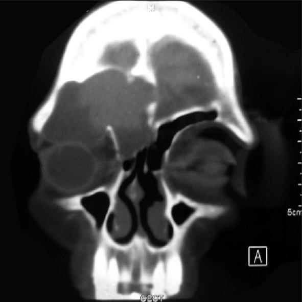 https://cdn.ncbi.nlm.nih.gov/pmc/blobs/8dda/3532760/27b0adf39f6a/AJNS-7-135-g001.jpg