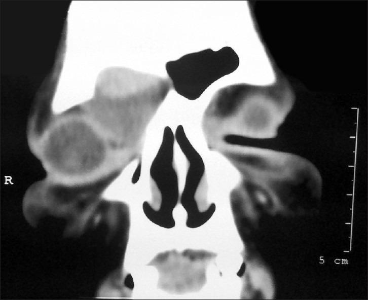 https://cdn.ncbi.nlm.nih.gov/pmc/blobs/8dda/3532760/44714bc15b86/AJNS-7-135-g004.jpg