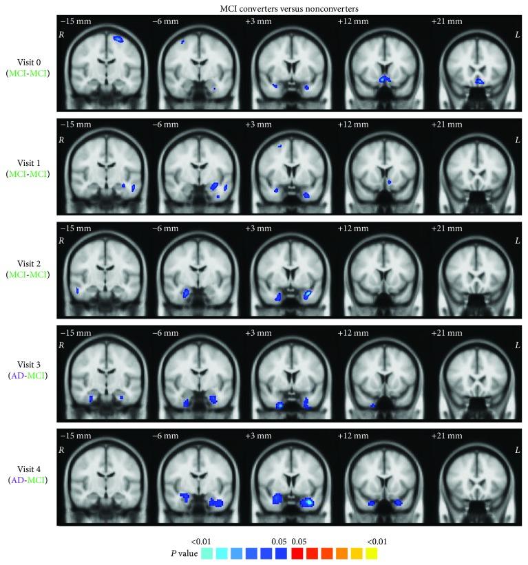 https://cdn.ncbi.nlm.nih.gov/pmc/blobs/8ddd/5884406/d0e1182f1b2e/BN2018-3954101.004.jpg
