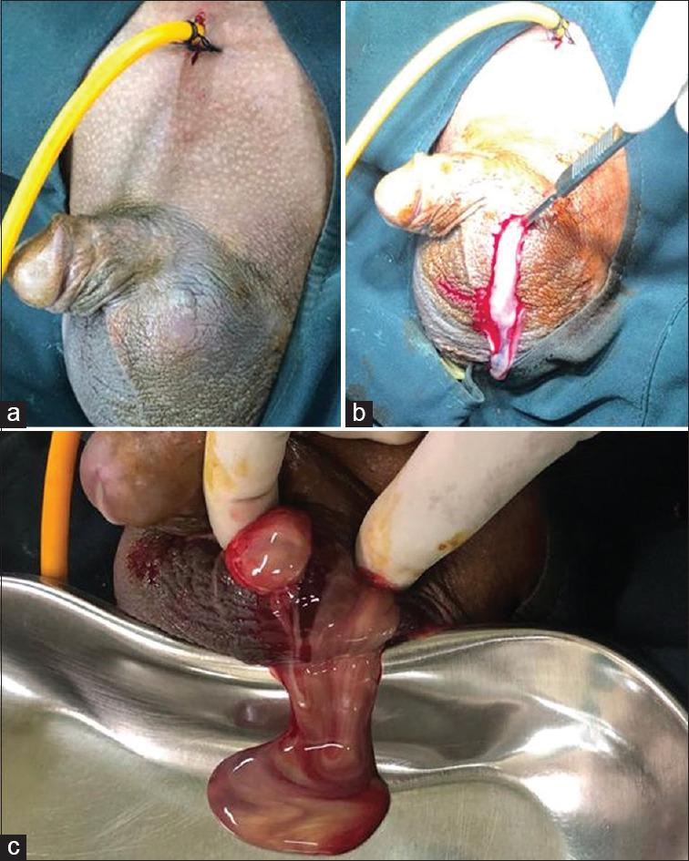 https://cdn.ncbi.nlm.nih.gov/pmc/blobs/8ddd/8052912/a8e4f36b8182/UA-13-83-g002.jpg
