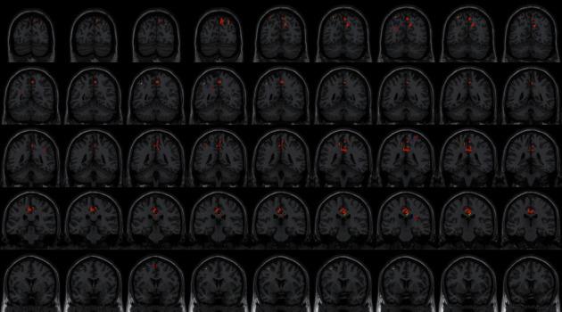 https://cdn.ncbi.nlm.nih.gov/pmc/blobs/8ddf/7744176/87063d664f19/ECAM2020-8836794.005.jpg