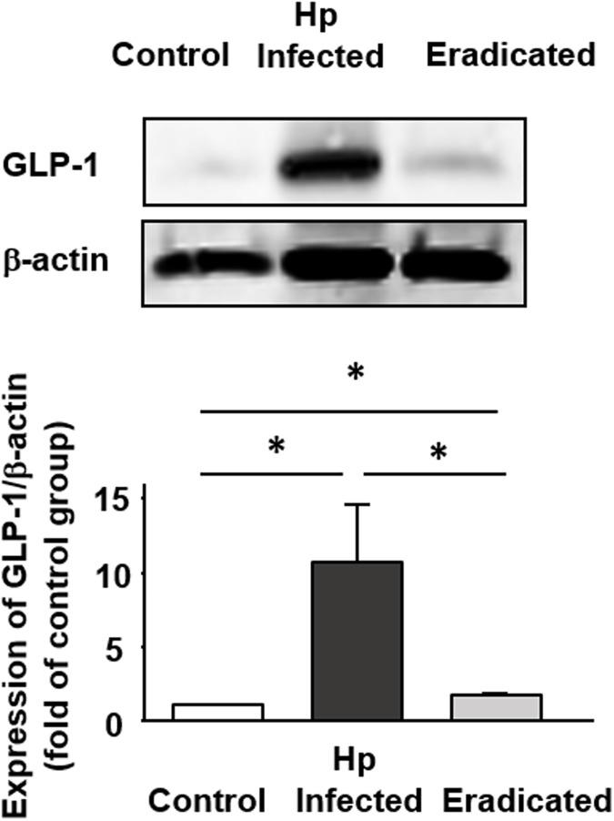 https://cdn.ncbi.nlm.nih.gov/pmc/blobs/8de2/5436696/6c61cda61ba4/pone.0177232.g005.jpg