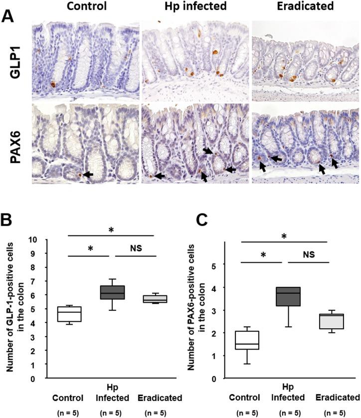 https://cdn.ncbi.nlm.nih.gov/pmc/blobs/8de2/5436696/7f8a1ed2a3a4/pone.0177232.g004.jpg