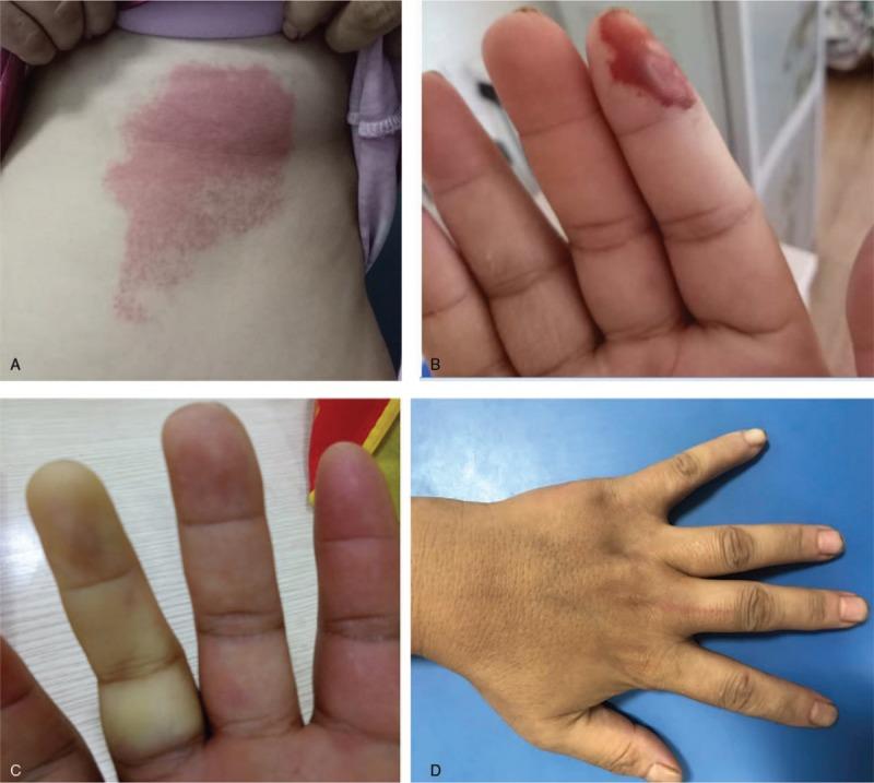 https://cdn.ncbi.nlm.nih.gov/pmc/blobs/8de2/6641847/594094e17caf/medi-98-e16382-g001.jpg