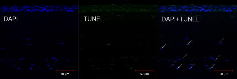 https://cdn.ncbi.nlm.nih.gov/pmc/blobs/8de7/3800280/f12cb1e36425/mv-v19-2113-f11.jpg