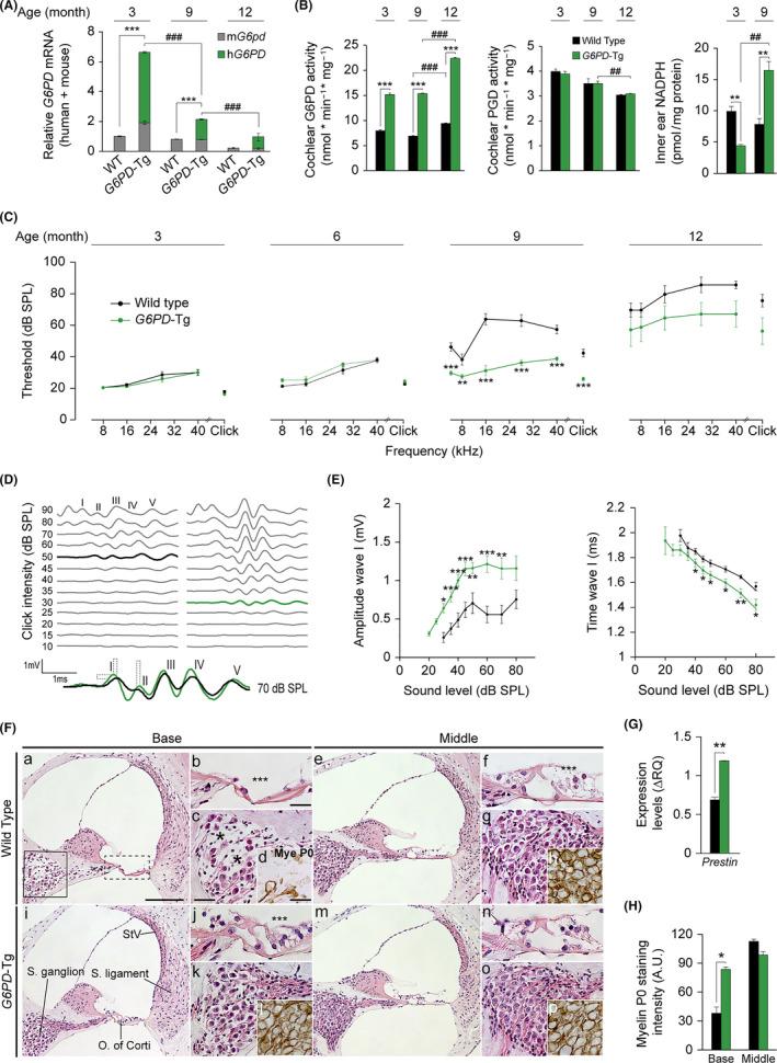 https://cdn.ncbi.nlm.nih.gov/pmc/blobs/8df1/7744953/bd1bc3d2c06b/ACEL-19-e13275-g001.jpg