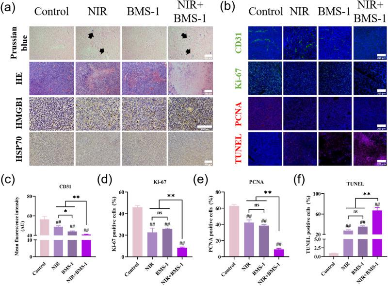 https://cdn.ncbi.nlm.nih.gov/pmc/blobs/8dfc/11268759/33734b0248ac/IJN-19-7185-g0005.jpg