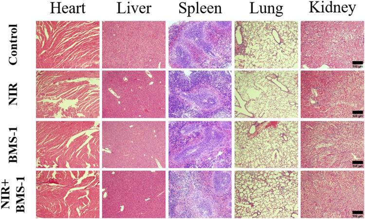 https://cdn.ncbi.nlm.nih.gov/pmc/blobs/8dfc/11268759/46fe12fa5015/IJN-19-7185-g0006.jpg
