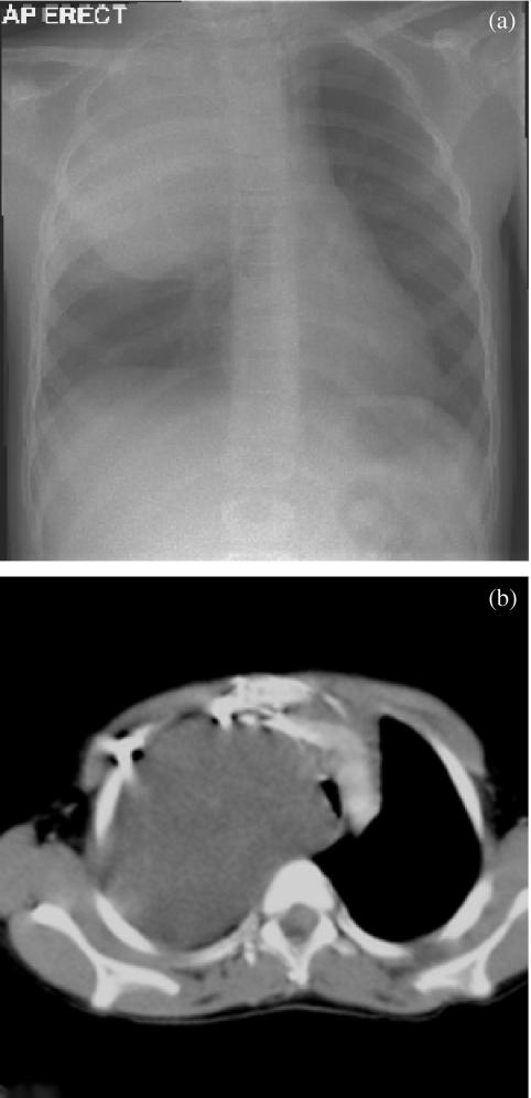 https://cdn.ncbi.nlm.nih.gov/pmc/blobs/8dfd/1665241/fd78cfd4f7fb/ci05011607.jpg