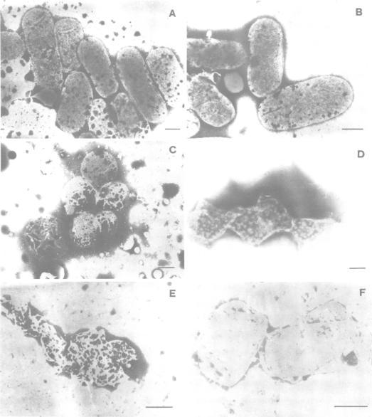 https://cdn.ncbi.nlm.nih.gov/pmc/blobs/8e02/218052/e4efaa141a79/jbacter00280-0341-a.jpg