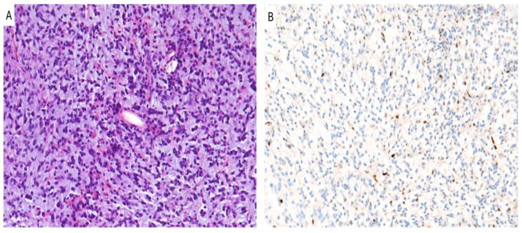 https://cdn.ncbi.nlm.nih.gov/pmc/blobs/8e0b/11506073/387c004b4204/cancers-16-03451-g001.jpg