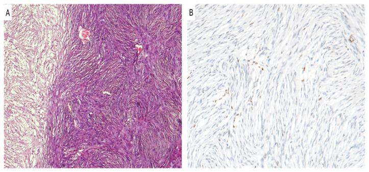 https://cdn.ncbi.nlm.nih.gov/pmc/blobs/8e0b/11506073/807b12656c20/cancers-16-03451-g004.jpg