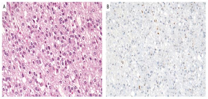 https://cdn.ncbi.nlm.nih.gov/pmc/blobs/8e0b/11506073/832bc25a765e/cancers-16-03451-g003.jpg
