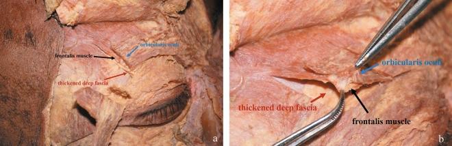 https://cdn.ncbi.nlm.nih.gov/pmc/blobs/8e10/11402955/1d11523f7bb7/41598_2024_72443_Fig2_HTML.jpg