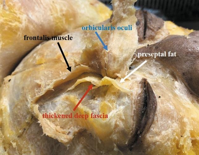https://cdn.ncbi.nlm.nih.gov/pmc/blobs/8e10/11402955/5e70f140931d/41598_2024_72443_Fig3_HTML.jpg