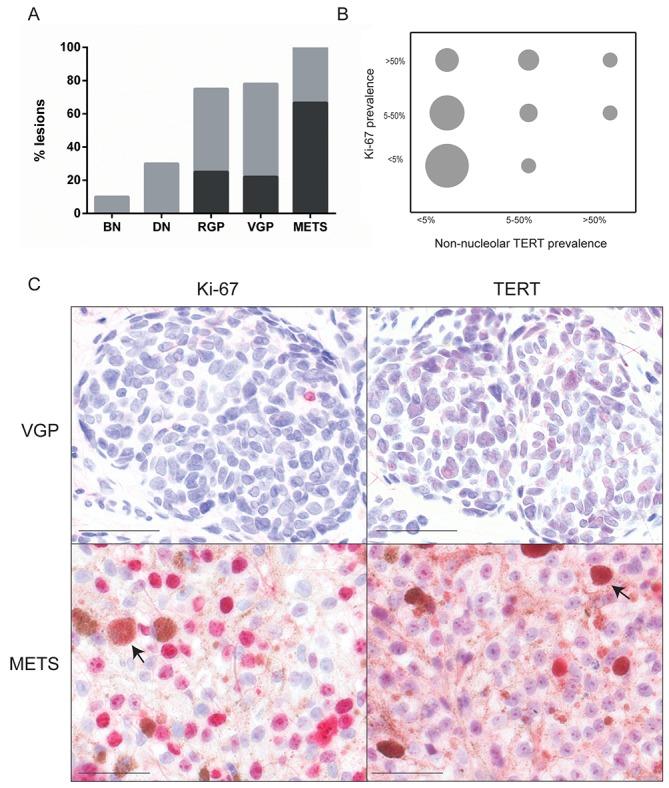 https://cdn.ncbi.nlm.nih.gov/pmc/blobs/8e12/5732815/2bad80778b34/oncotarget-08-104408-g003.jpg
