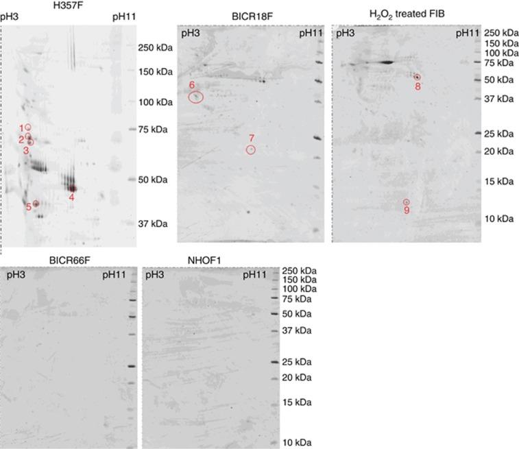https://cdn.ncbi.nlm.nih.gov/pmc/blobs/8e13/4453858/30ba98b52efe/bjc2014438f2.jpg