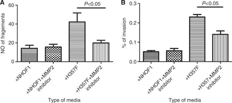 https://cdn.ncbi.nlm.nih.gov/pmc/blobs/8e13/4453858/75da7d9ec5cf/bjc2014438f4.jpg