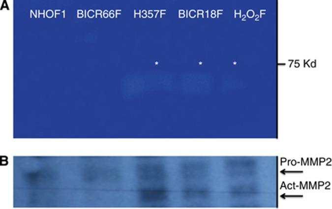 https://cdn.ncbi.nlm.nih.gov/pmc/blobs/8e13/4453858/e5bd5877646d/bjc2014438f3.jpg