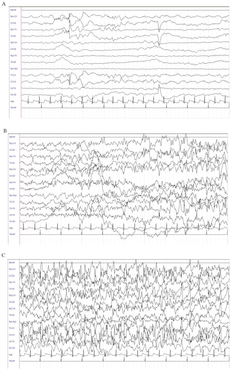 https://cdn.ncbi.nlm.nih.gov/pmc/blobs/8e13/7699678/1169f2f2cbe1/brainsci-10-00885-g002a.jpg