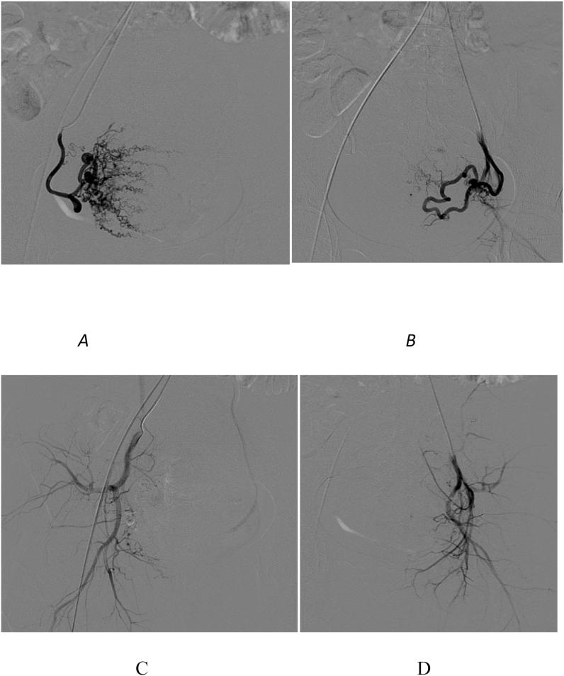 https://cdn.ncbi.nlm.nih.gov/pmc/blobs/8e15/9617151/0295800a8c0f/gr1.jpg