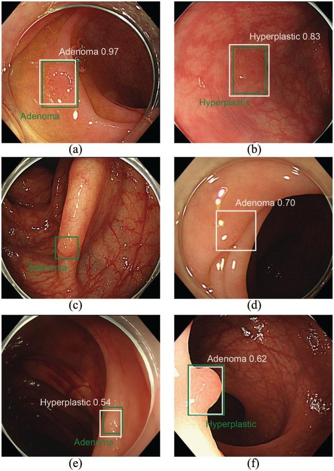 https://cdn.ncbi.nlm.nih.gov/pmc/blobs/8e17/7092386/d2207941fe39/10.1177_1756284820910659-fig3.jpg