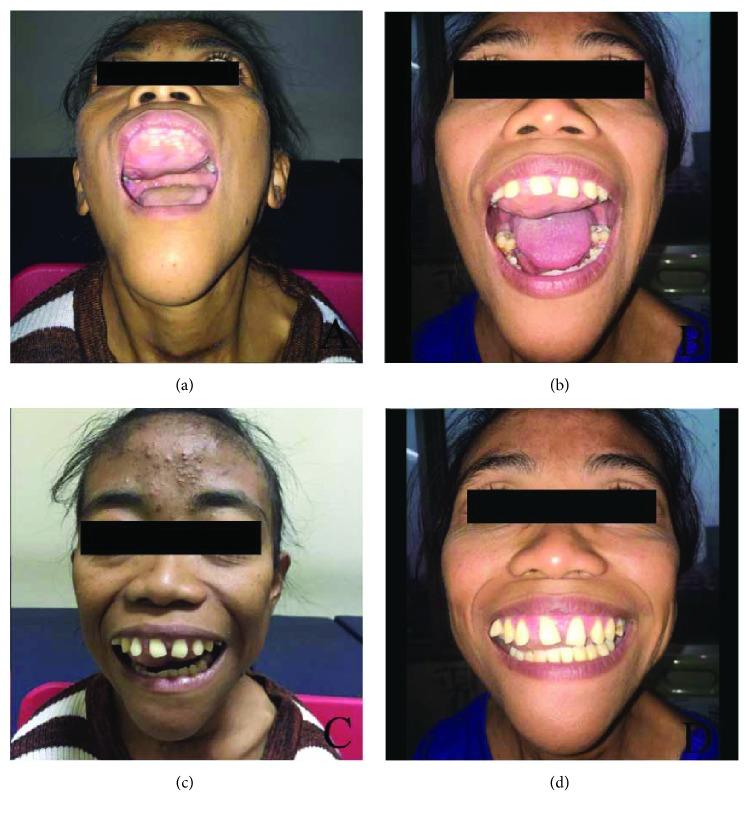 https://cdn.ncbi.nlm.nih.gov/pmc/blobs/8e1e/6157168/146122f530ec/CRIONM2018-1801652.001.jpg