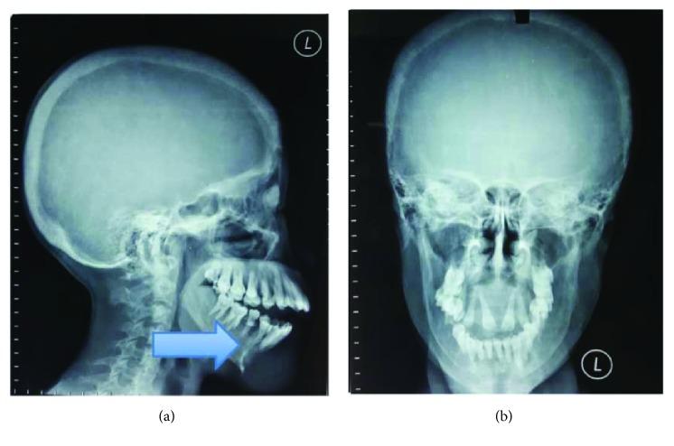 https://cdn.ncbi.nlm.nih.gov/pmc/blobs/8e1e/6157168/25ef2836cd2c/CRIONM2018-1801652.002.jpg