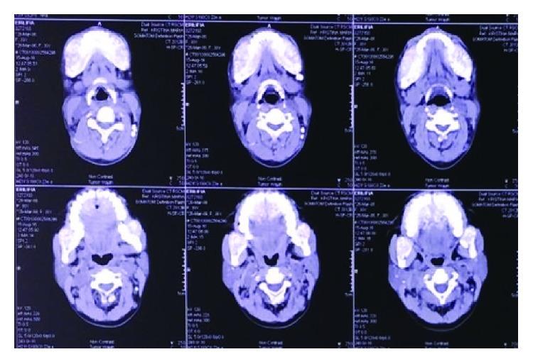 https://cdn.ncbi.nlm.nih.gov/pmc/blobs/8e1e/6157168/b2766c5e48ec/CRIONM2018-1801652.007.jpg