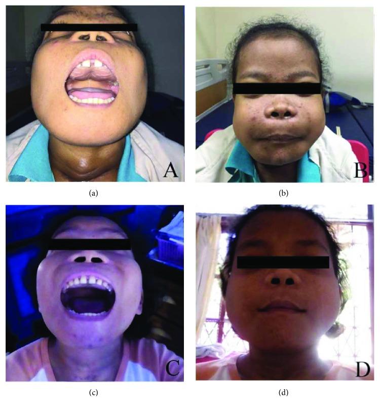 https://cdn.ncbi.nlm.nih.gov/pmc/blobs/8e1e/6157168/c776f80f2150/CRIONM2018-1801652.005.jpg