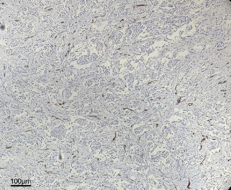 https://cdn.ncbi.nlm.nih.gov/pmc/blobs/8e2a/10793828/67c390e4f434/IJMR-158-417-g001.jpg
