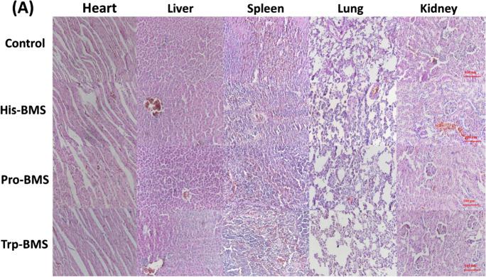 https://cdn.ncbi.nlm.nih.gov/pmc/blobs/8e2b/9970140/f6d49c986b06/11051_2023_5690_Fig14_HTML.jpg