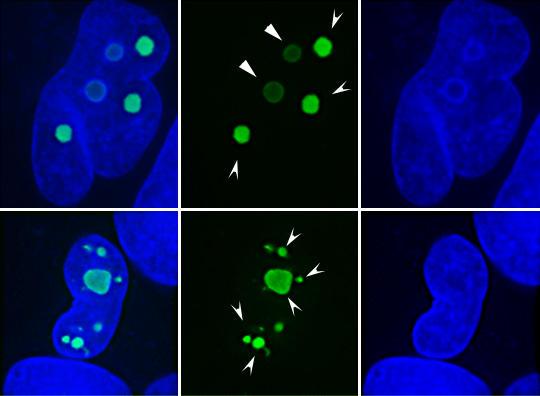https://cdn.ncbi.nlm.nih.gov/pmc/blobs/8e2d/153488/3e47cdf6cbf7/1476-4598-2-18-1.jpg