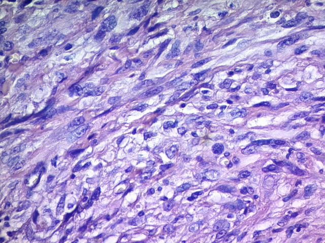 https://cdn.ncbi.nlm.nih.gov/pmc/blobs/8e30/9590819/9101858f6285/1853-0605-79-3-294-g003.jpg