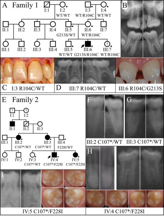 https://cdn.ncbi.nlm.nih.gov/pmc/blobs/8e31/4299714/363b632267a0/mgg30003-0040-f6.jpg