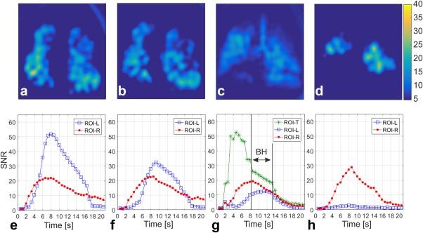 https://cdn.ncbi.nlm.nih.gov/pmc/blobs/8e31/5836876/6f4b8700ada9/MRM-79-2597-g005.jpg
