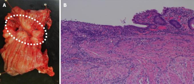 https://cdn.ncbi.nlm.nih.gov/pmc/blobs/8e32/8283613/fde0bd7dd745/WJCC-9-5270-g003.jpg