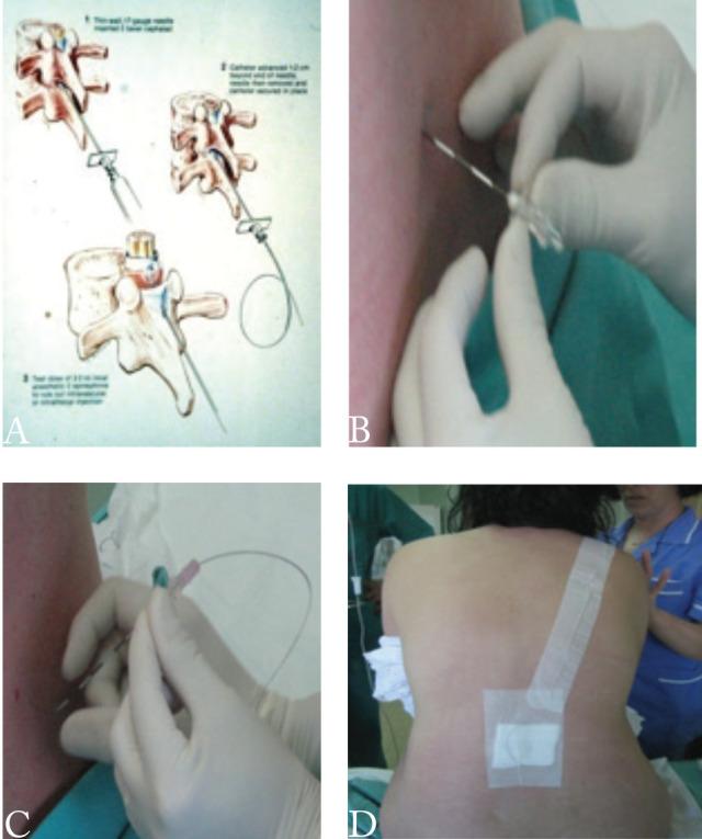 https://cdn.ncbi.nlm.nih.gov/pmc/blobs/8e3c/9942471/7baf7aadf280/acc-61_supp2-9-f1.jpg