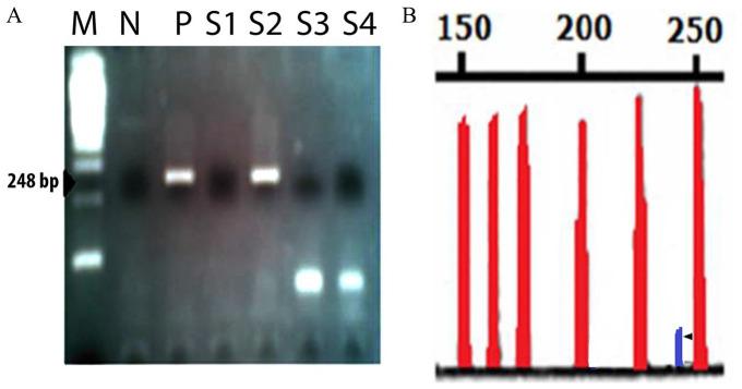https://cdn.ncbi.nlm.nih.gov/pmc/blobs/8e45/7691892/7329537c83d7/10.1177_1178223420976388-fig1.jpg