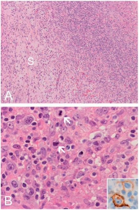https://cdn.ncbi.nlm.nih.gov/pmc/blobs/8e46/3205762/04e16a276e3d/ci11002002.jpg