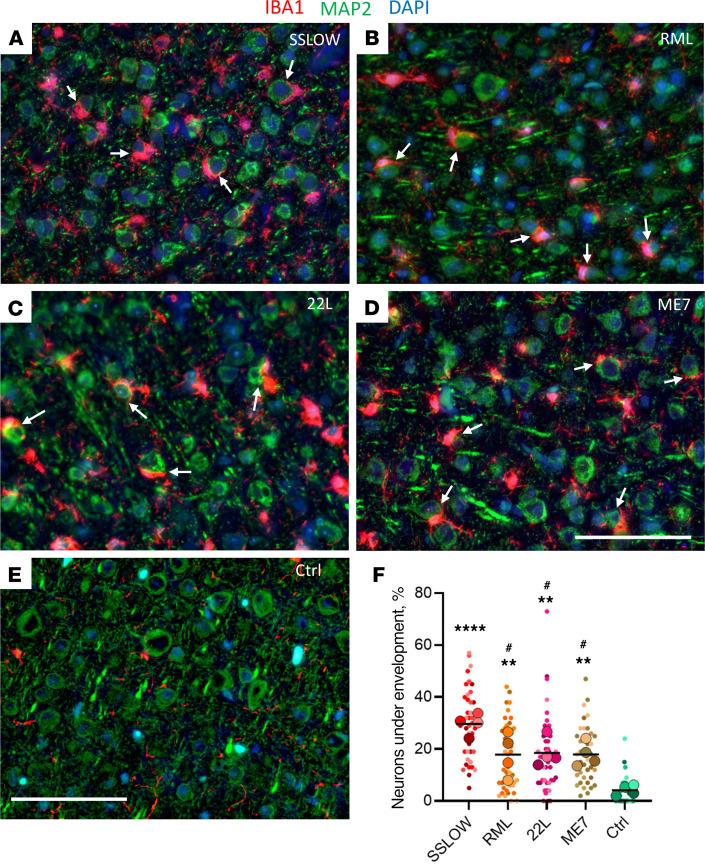 https://cdn.ncbi.nlm.nih.gov/pmc/blobs/8e4c/11601909/2b316028cdf5/jci-134-181169-g028.jpg
